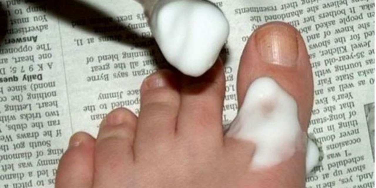 Ayak baş parmağına karbonat döktü - Gördüğü şeyden sonra hemen herkese tavsiye etti